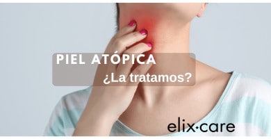piel at&oacute;pica: imagen mujer con eccema en el cuello