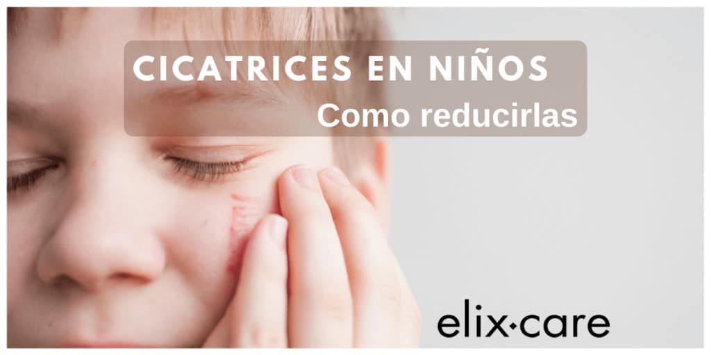 reducir eliminar cicatrices con parches cicatrizantes en niños y bebés