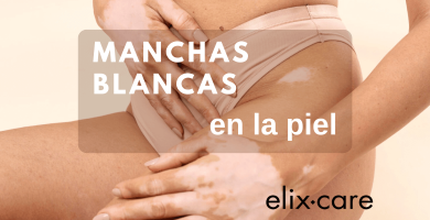 Manchas Blancas ne la Piel razones